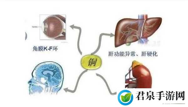 铜铜铜铜铜铜好多疼！如何有效缓解铜中毒症状-铜中毒，1. 了解铜中毒：如何有效缓解症状与预防